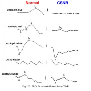 CSNB20