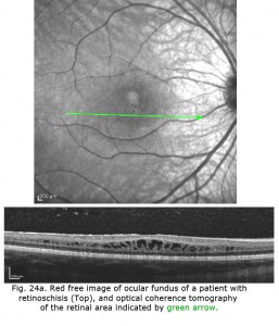 Fig24a